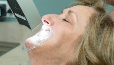Teeth Whitening