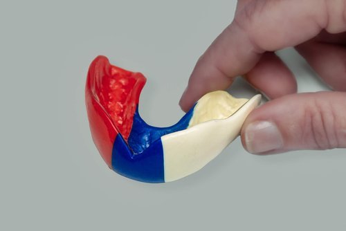 Custom sports mouthguard for dental protection