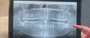 Immediate treatment for dental emergencies.