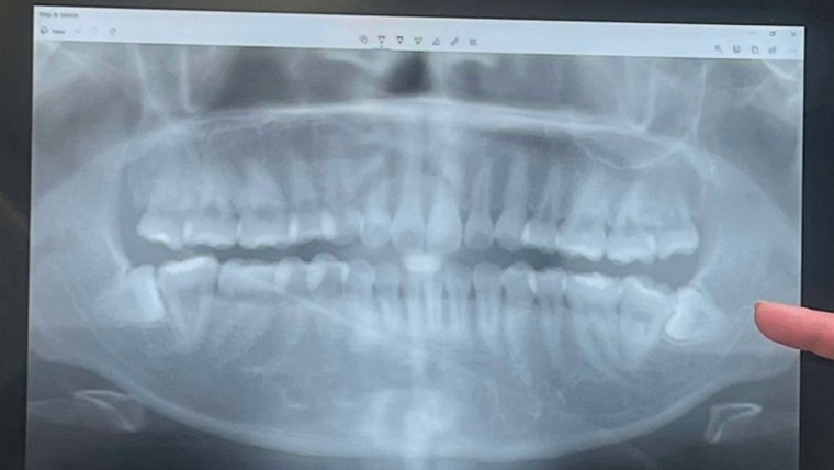 Immediate treatment for dental emergencies.