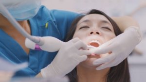 Differences between deep cleaning and periodontal maintenance.