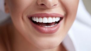 Things to avoid after a teeth whitening treatment.