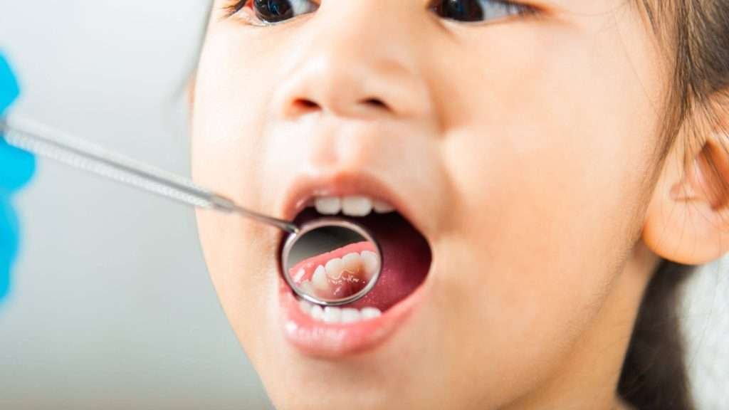 Guidelines for starting children's orthodontic treatment in Allen, Texas.