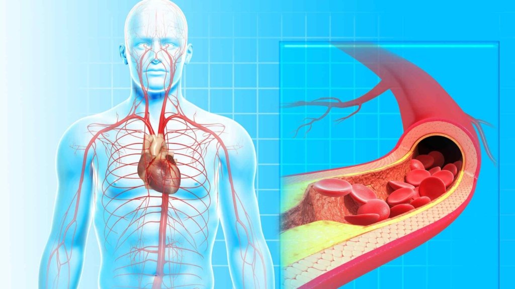 How undetected dental disease affects overall health.