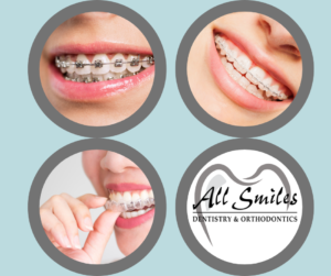 Different types of braces and how they function.