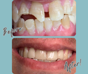 What to do in a dental emergency.