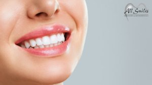 Procedure, benefits, and risks of teeth whitening.
