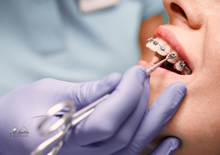 Dentist adjusting a patients braces