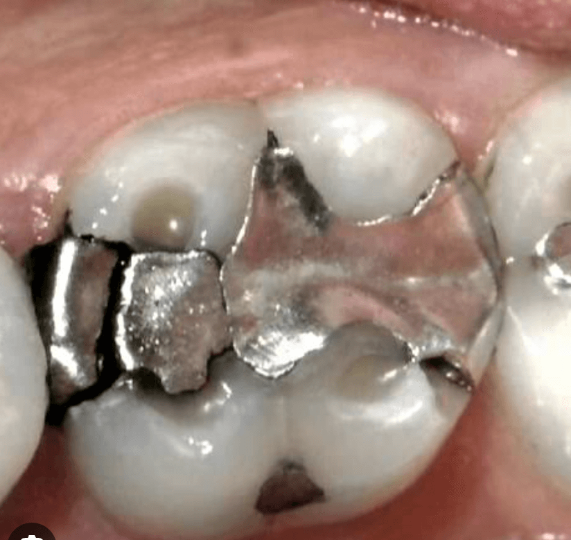 Failing filling