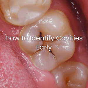 How to Identify Cavities Early