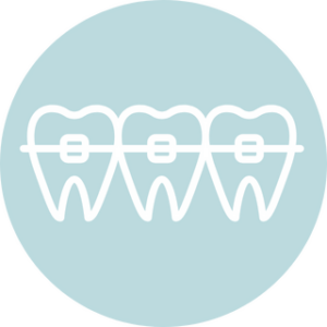 Illustration of dental braces on teeth, representing orthodontic treatment