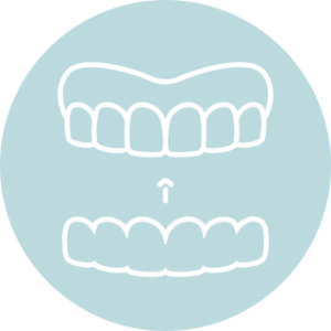 Illustration of clear dental aligners representing Invisalign orthodontic treatment
