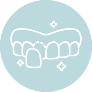 Illustration of a dental veneer being applied to a tooth, representing cosmetic dental treatment