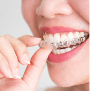 Beautiful girl wearing Invisalign aligners