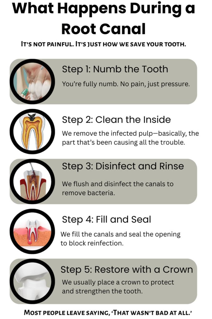 What Happens During a Root Canal Infographic
