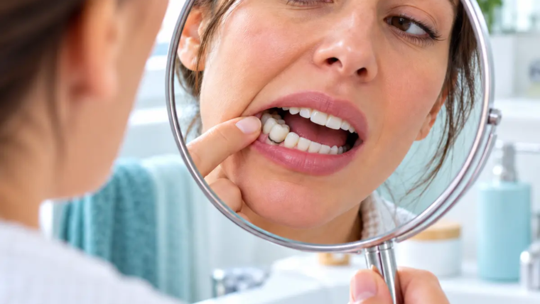 How Often Do Dental Crowns Need to Be Replaced for Long-Term Oral Health