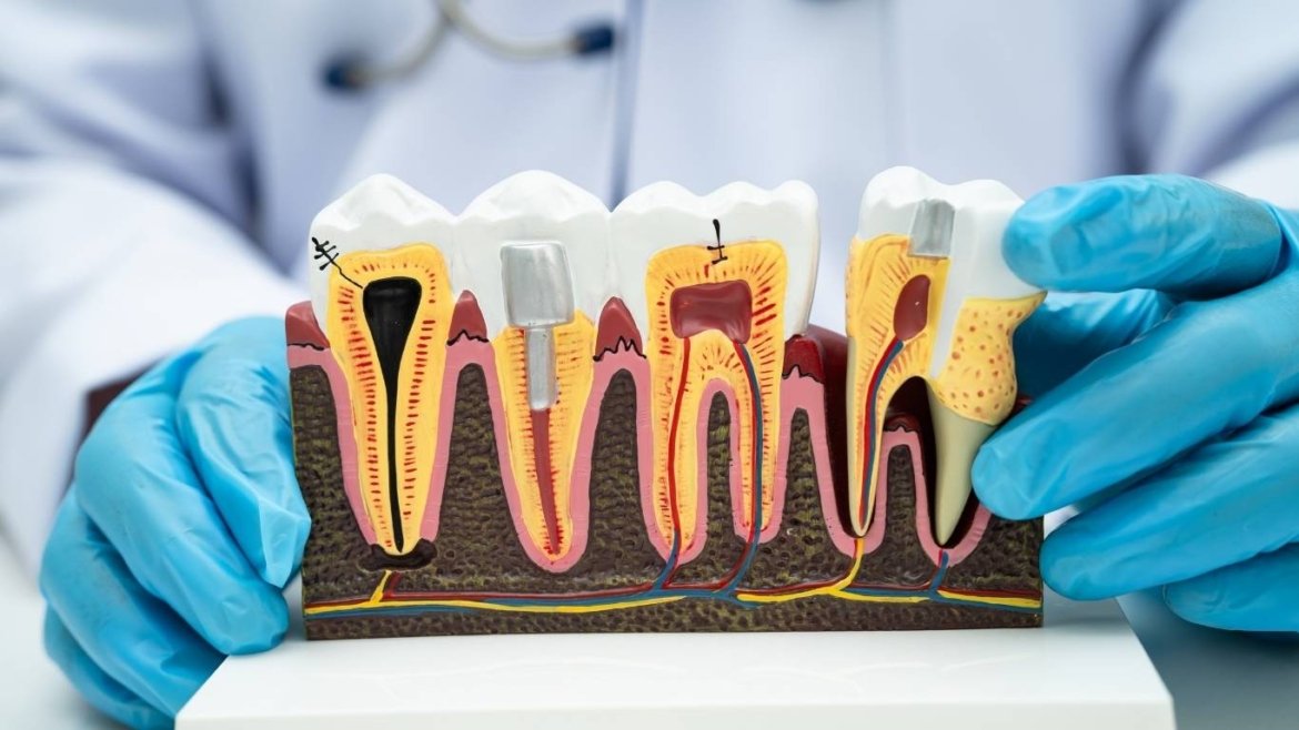 How-Root-Canals-Save-Natural-Teeth-and-Prevent-Bigger-Dental-Problems