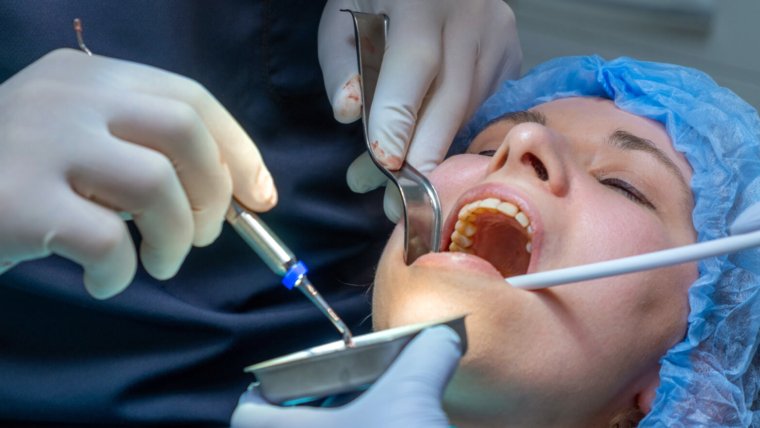 Do You Need a Bone Graft Before Getting Dental Implants?