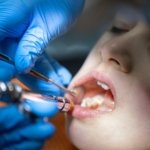 infection after tooth extraction