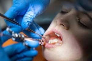 infection after tooth extraction