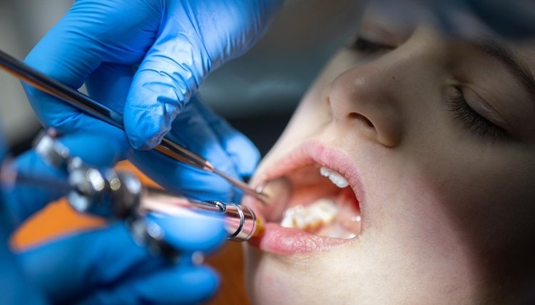 Infection After Tooth Extraction: Warning Signs You Shouldn’t Ignore 