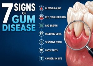 7 Signs of Gum Disease