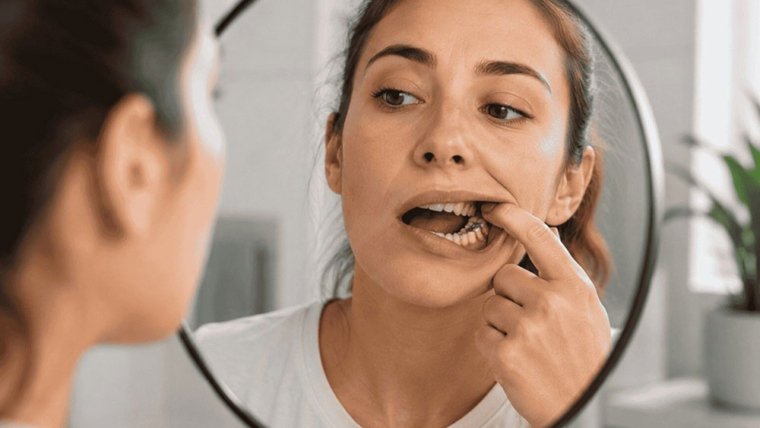 What’s Hiding Under Your Old Fillings?