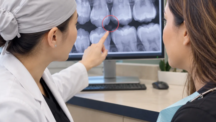 Dental X-Rays and Early Detection Explained
